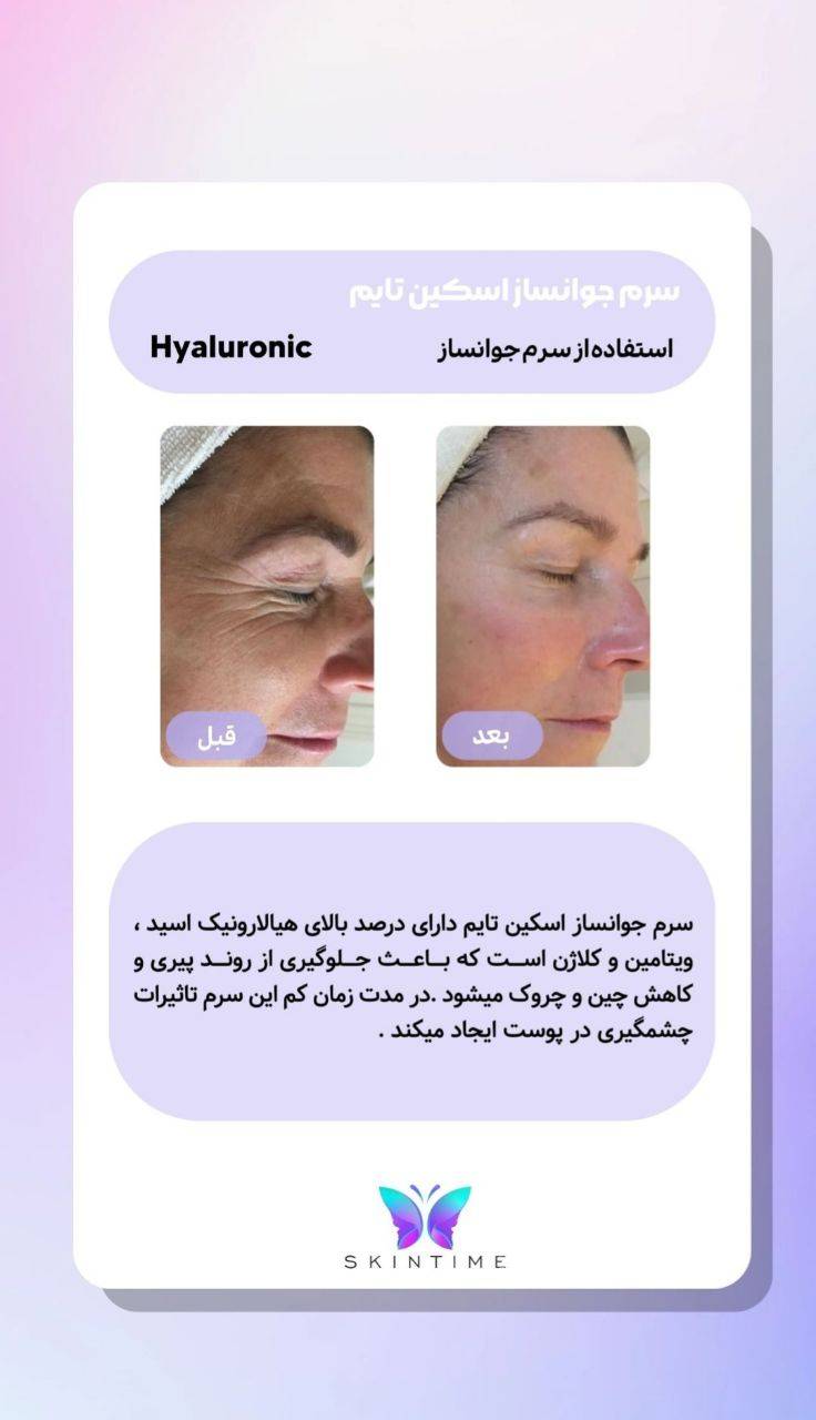 ویال